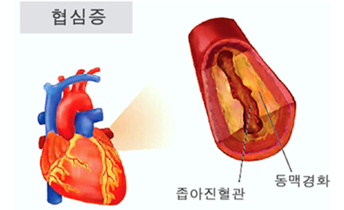이미지명